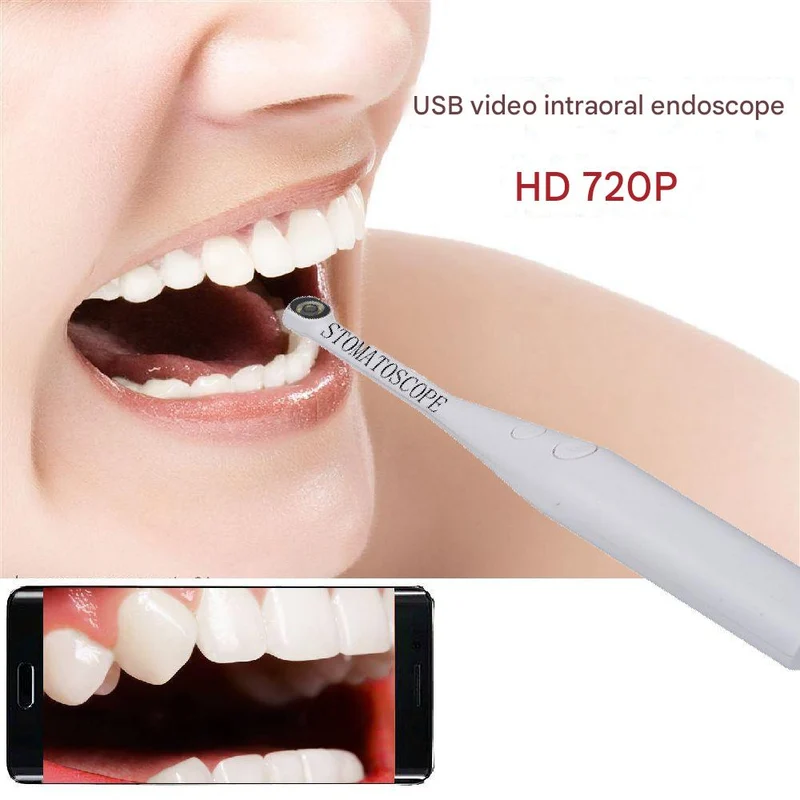 720P Stomatoscope With 6 LED Light At head & 80 Degree LargeVisualAngle Suitable ForKids, Pets & Adults IP67 Waterproof